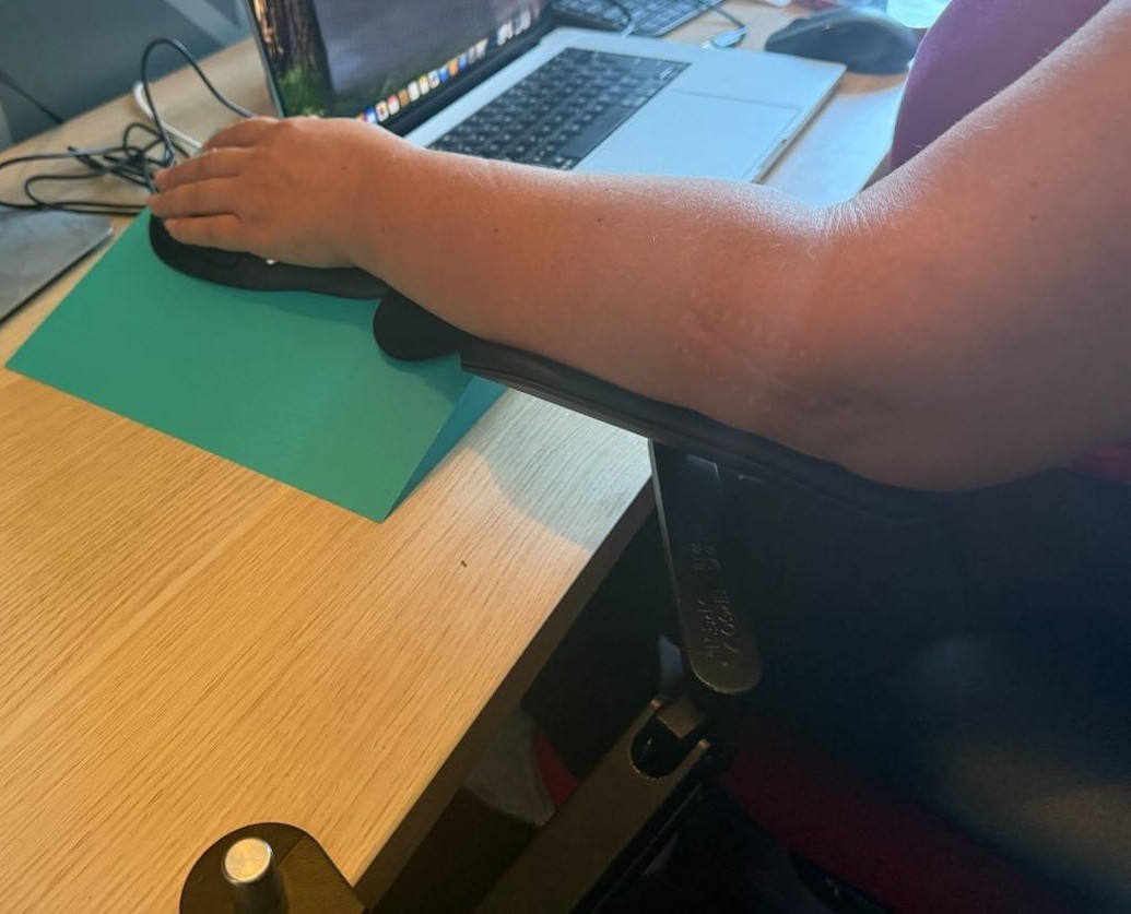The final result, the client using the 3D printed angled wrist support, with the rest of her ergonomic set-up.
